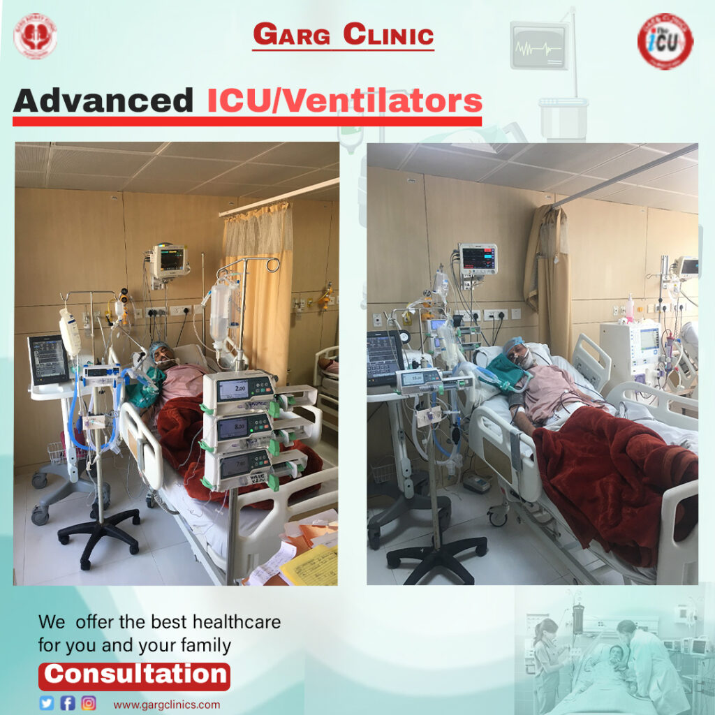 Advanced icu vetilation